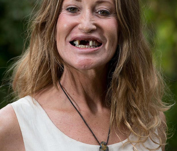 Сонник гнилые зубы