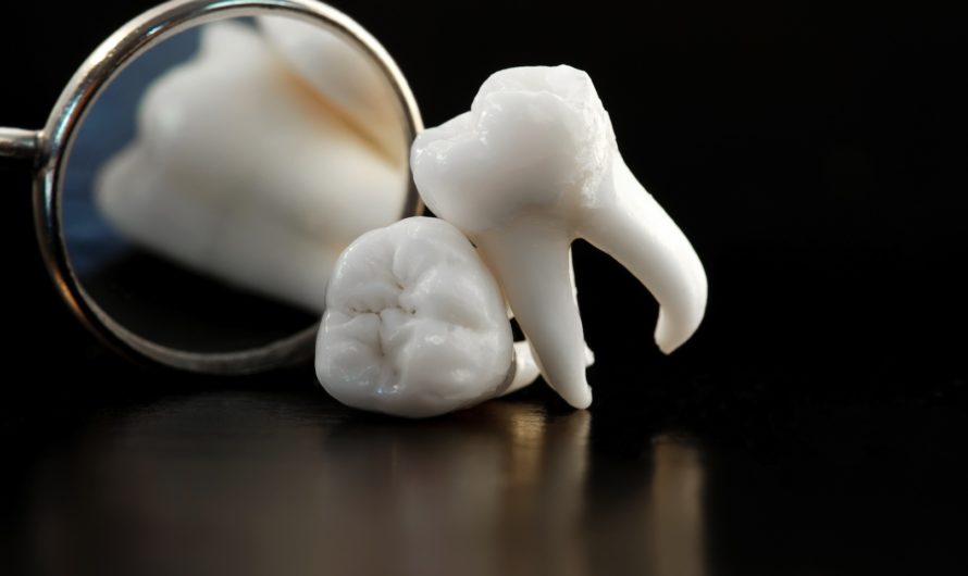 Сонник: зуб шатается