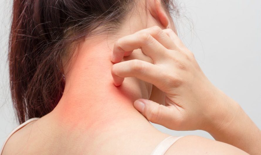 Сонник: Зуд