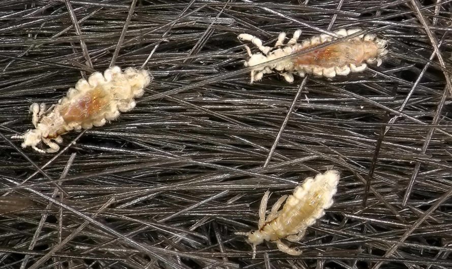 Сонник: Вши