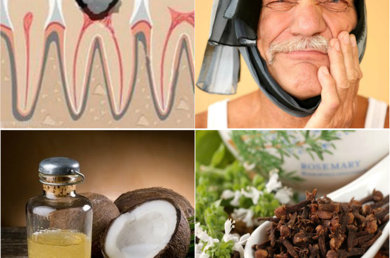 Народные средства от зубной боли