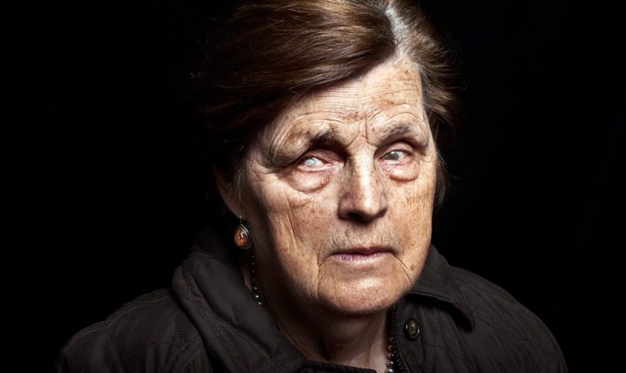 Сонник  ослепнуть