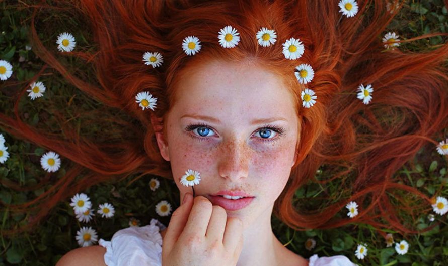 Сонник: Веснушки