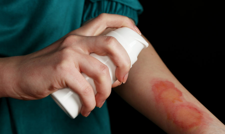 Сонник Ожоги