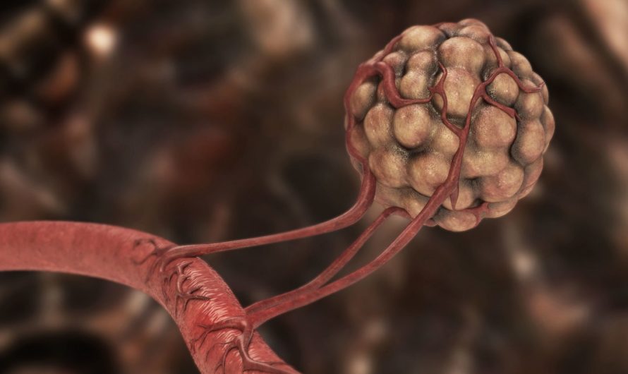 Сонник Опухоль