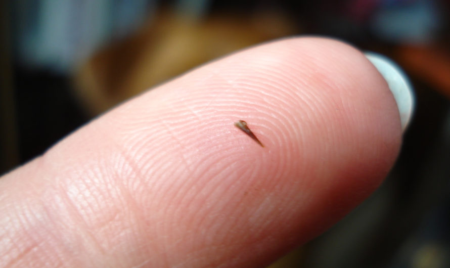 Сонник: Заноза