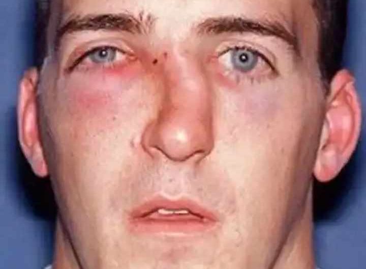 Сонник Сломанный