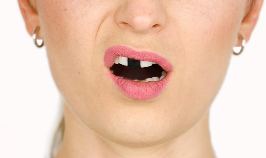 Сонник: откололся зуб