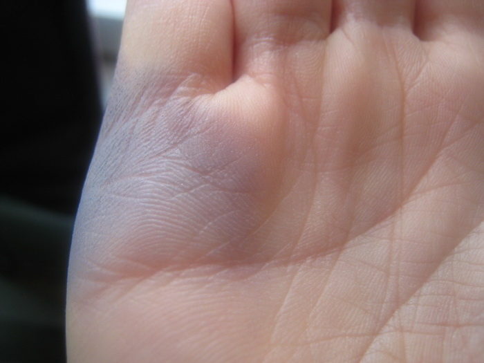 Знак на линии брака значение