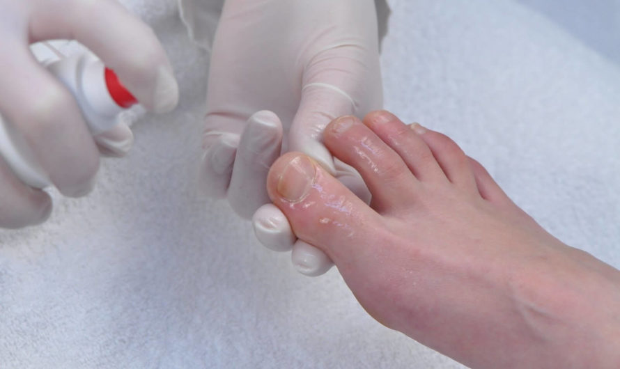 Лечение ногтей на ногах