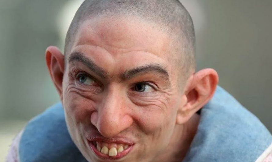 Сонник: Урод