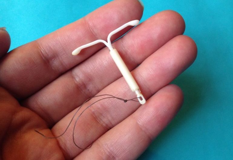 Спирали внутриматочные